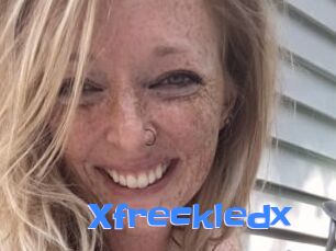 Xfreckledx